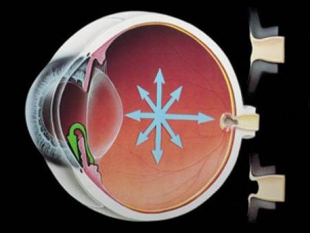 Глаукомата – първопричина за ослепяване