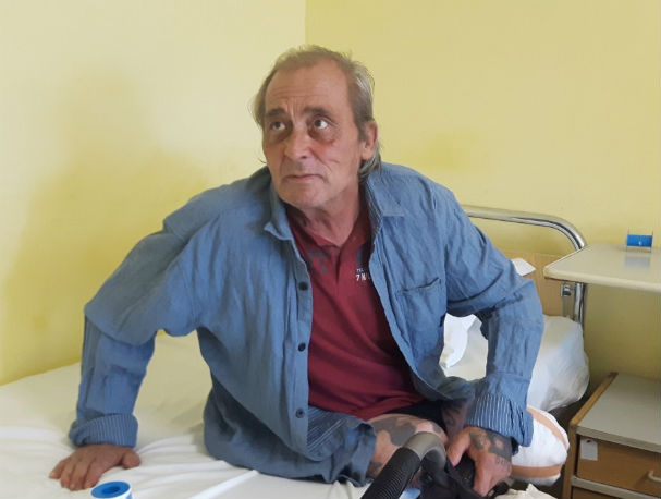 Бездомник с ампутирани крака живее вече месец в УМБАЛ-Бургас
