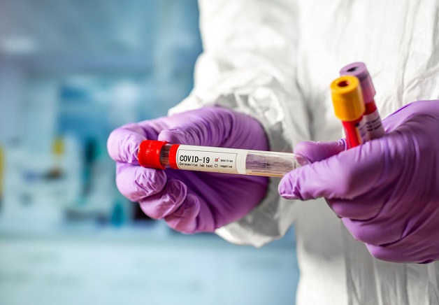 България е заявила 1 милион теста за коронавирус