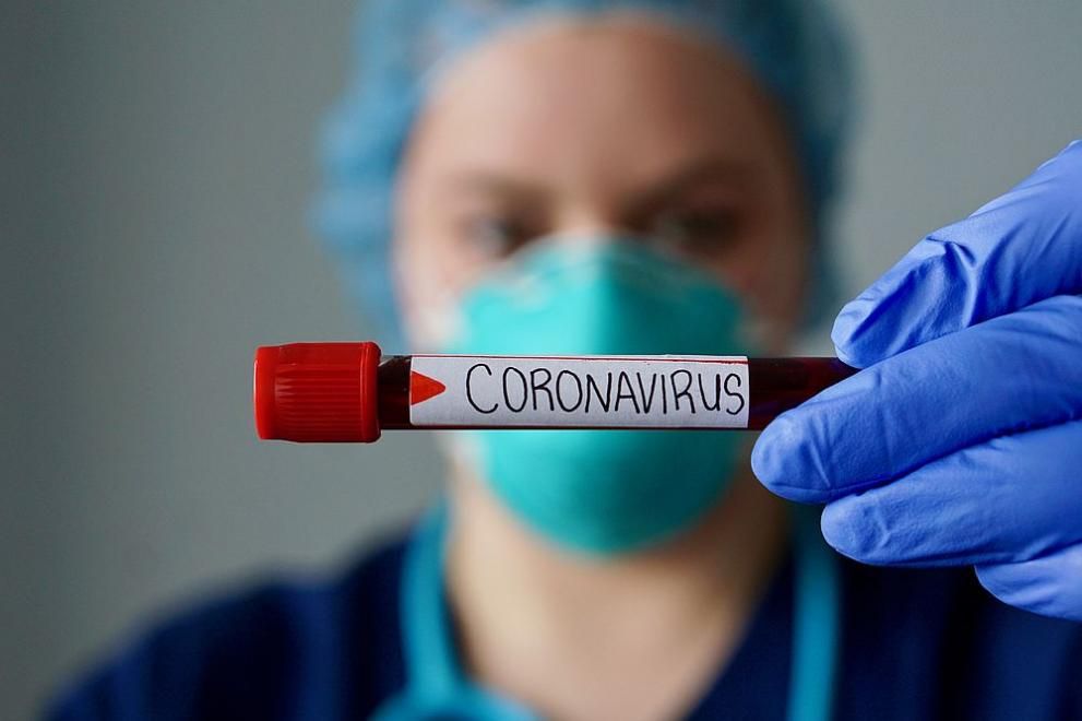 79 са новите положителни проби за коронавирус в страната