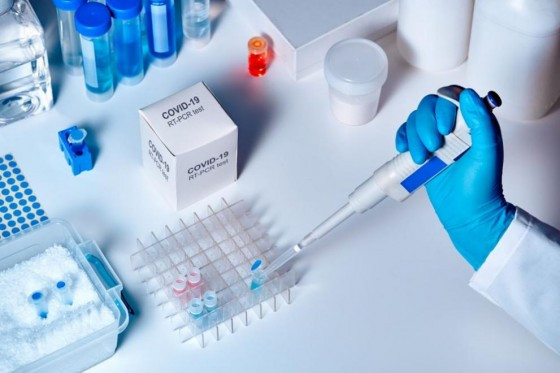 Купуваме още 42 000 Real-time PCR теста за коронавирус от Корея