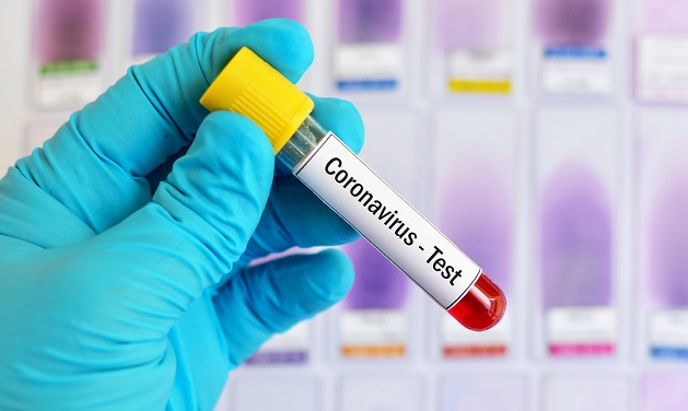 Безплатни бързи тестове за коронавирус в бургаските училища и детски градини