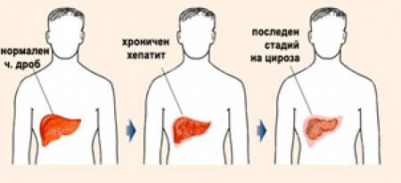 Проблеми с черния дроб