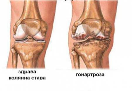 Старостта не е порок, но не е и „златна възраст“