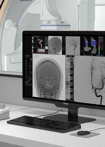 УМБАЛ Бургас оборудва със супер модерна апаратура за инвазивна диагностика нова ангиографска зала